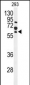 FZD4 Antibody (C-term)